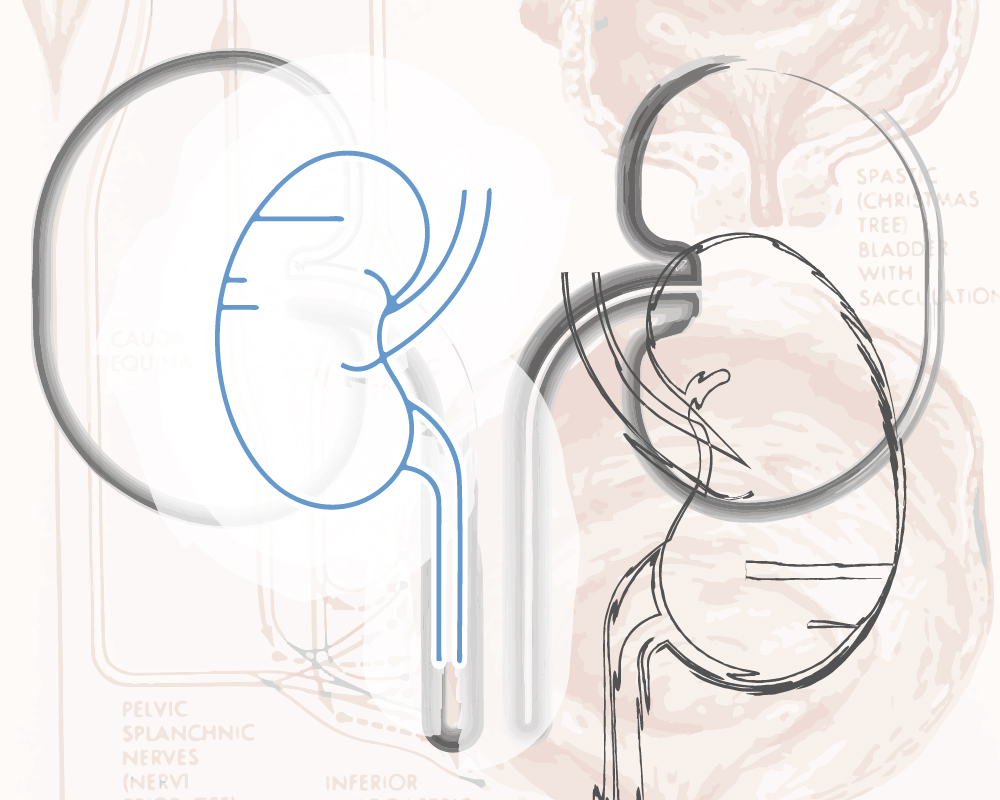 Erster Urotherapie-Verein am Universitätsklinikum Bonn + + + mehr: