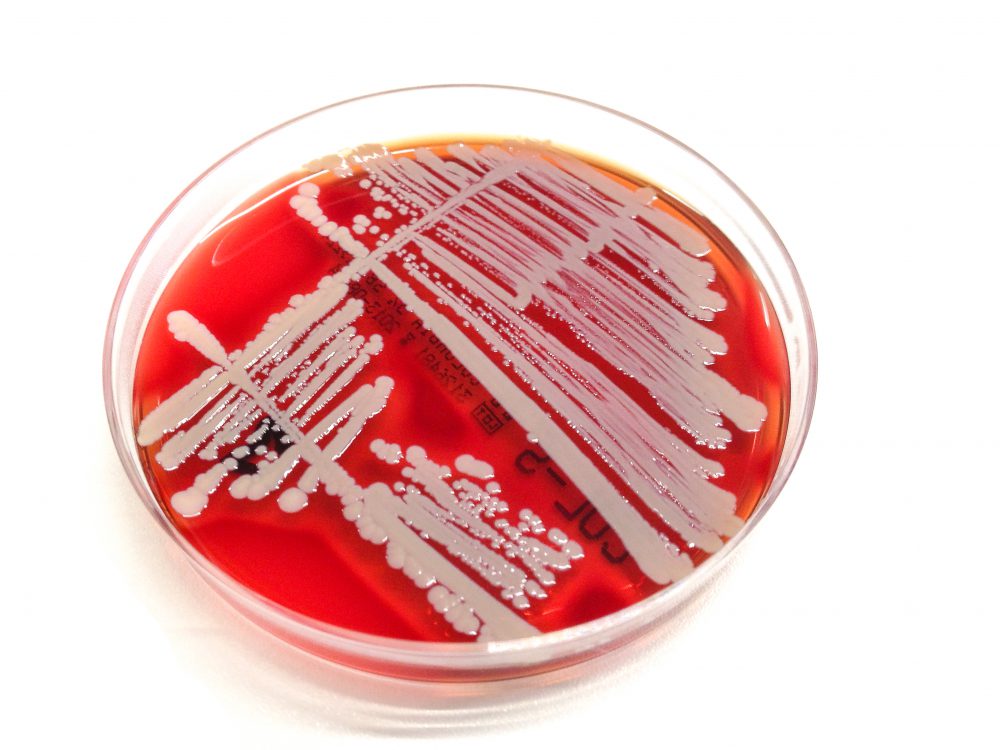 Staphylococcus aureus