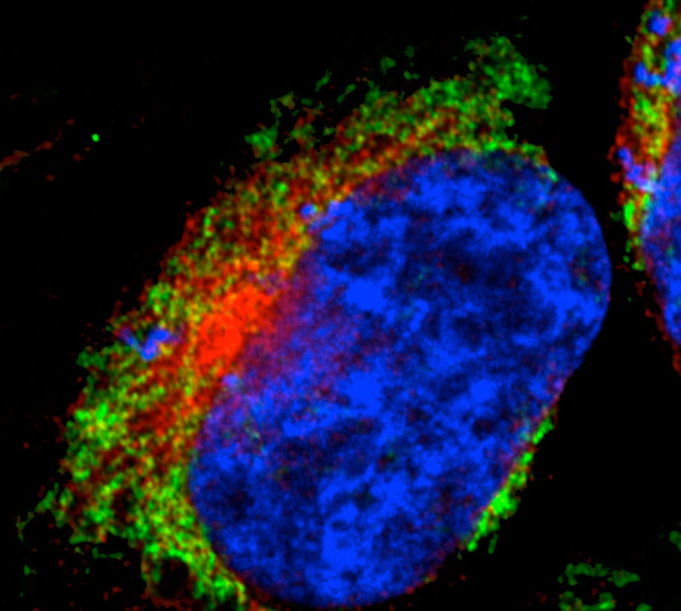 Alzheimer-Toxine legen Kraftwerke der Zelle lahm