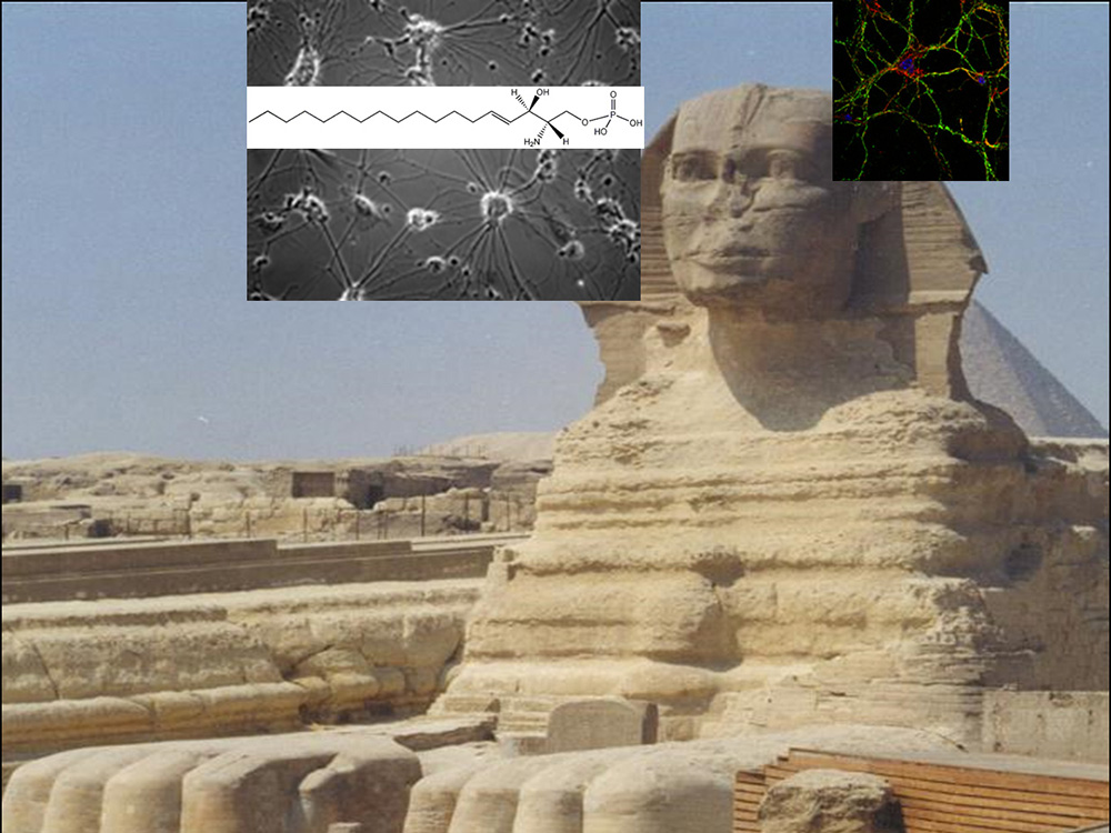 Aufnahme Signalübertragung im Gehirn vor Bild von Sphinx