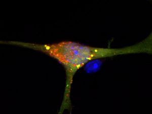 Nervenzelle mit gestörtem S1P-Abbau