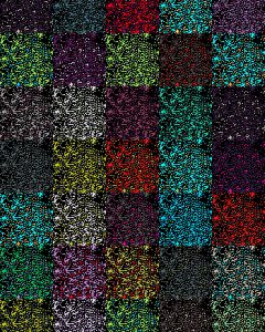 Das Mosaik aus Photorezeptorzellen auf der menschlichen Netzhaut
