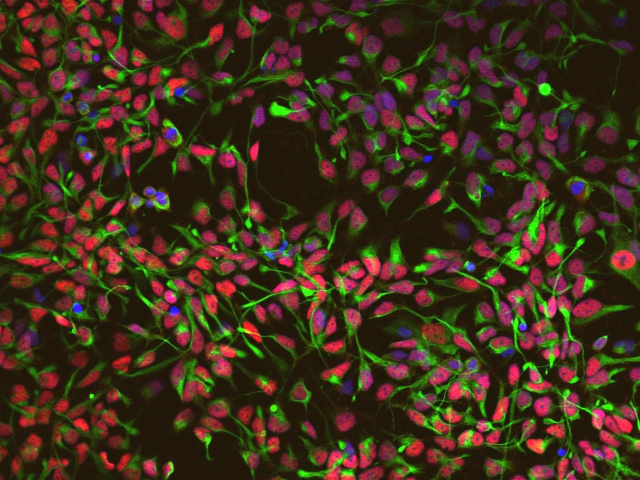 Induzierte neurale Stammzellen (iNSC)