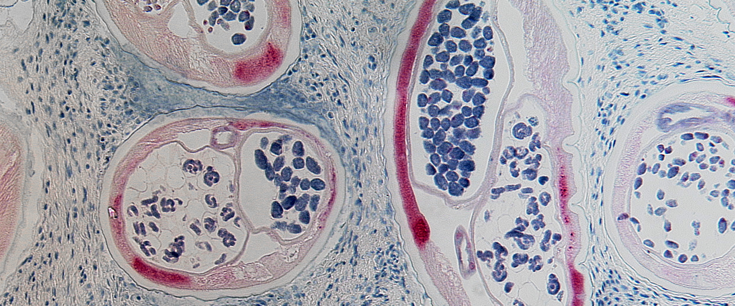 Histologischer Schnitt von Onchocerca volvulus, dem Erreger der Flussblindheit, unter dem Mikroskop