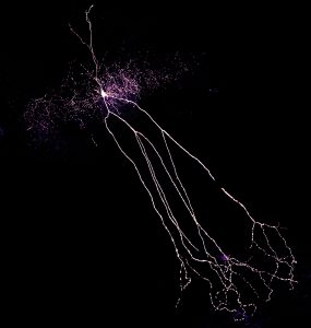 Ein Interneuron (hell, mit langen Fortsätzen) aus dem Hippokampus der Ratte
