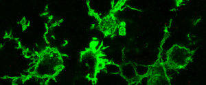 Mikroskopisches Bild von grün angefärbten Makrophagen