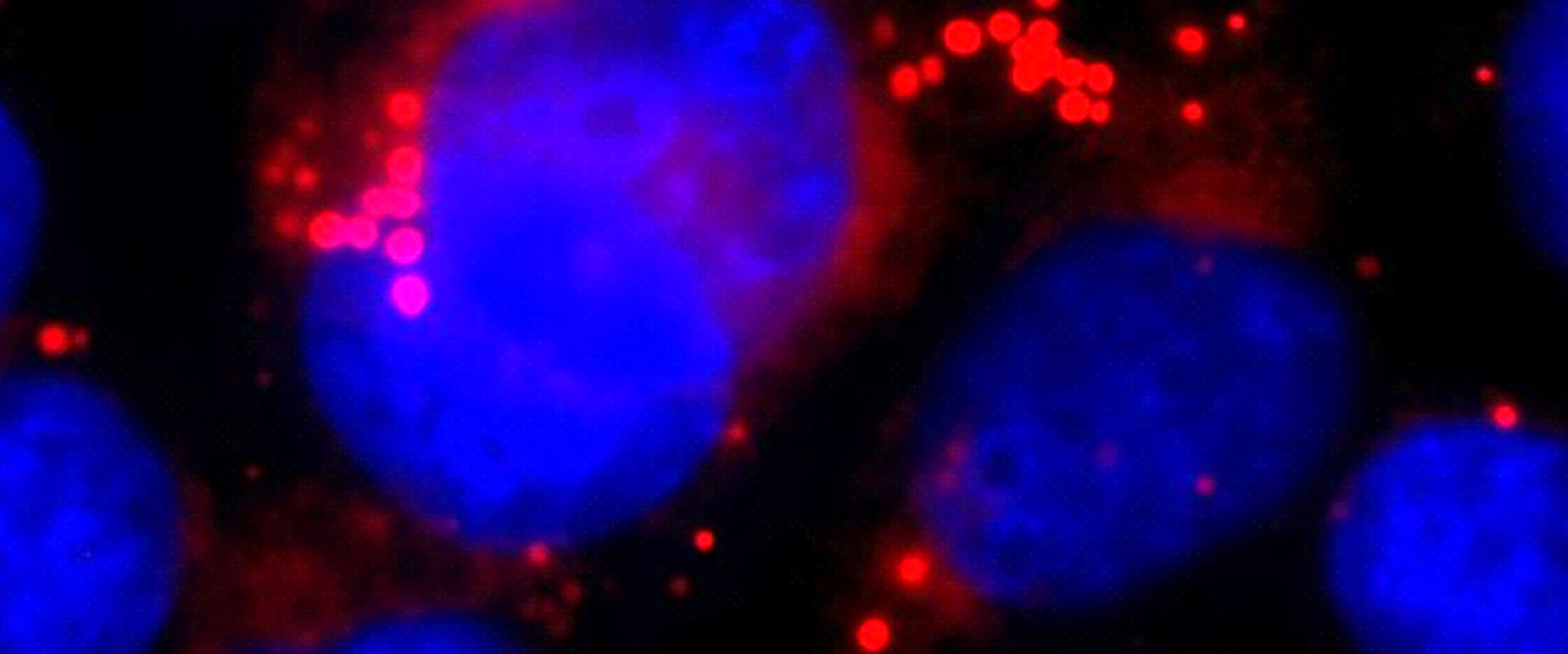 Hirnzellen: Astrozyten (ihr Zellkern ist blau gefärbt) und Lipidtröpfchen (rot)