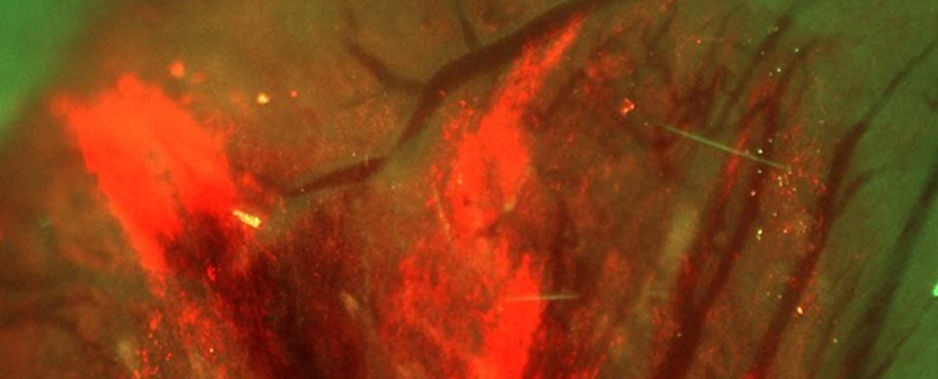 Herzmuskelzellen unter dem Mikroskop