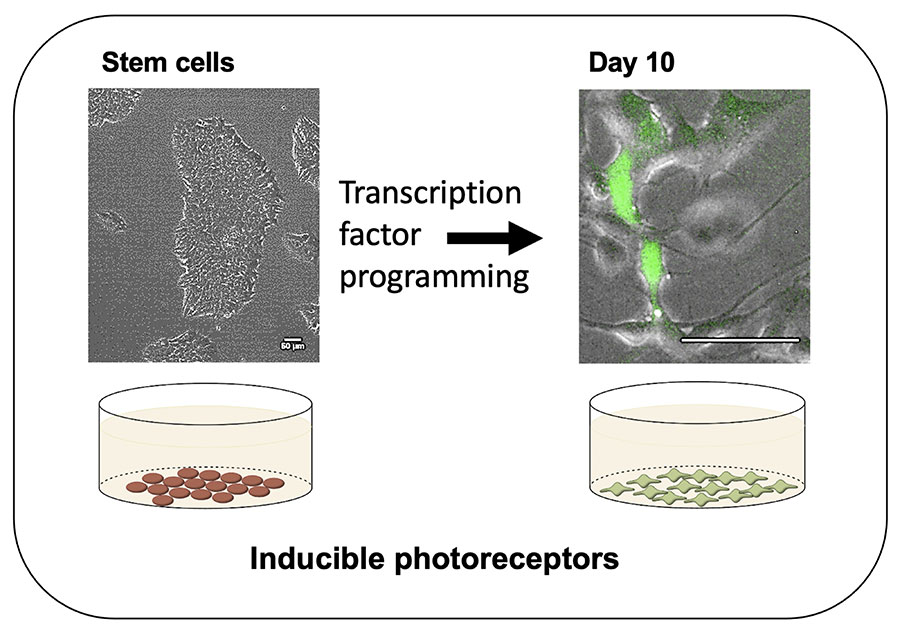 Aus menschlichen Stammzellen werden im Labor Photorezeptor-Zellen.