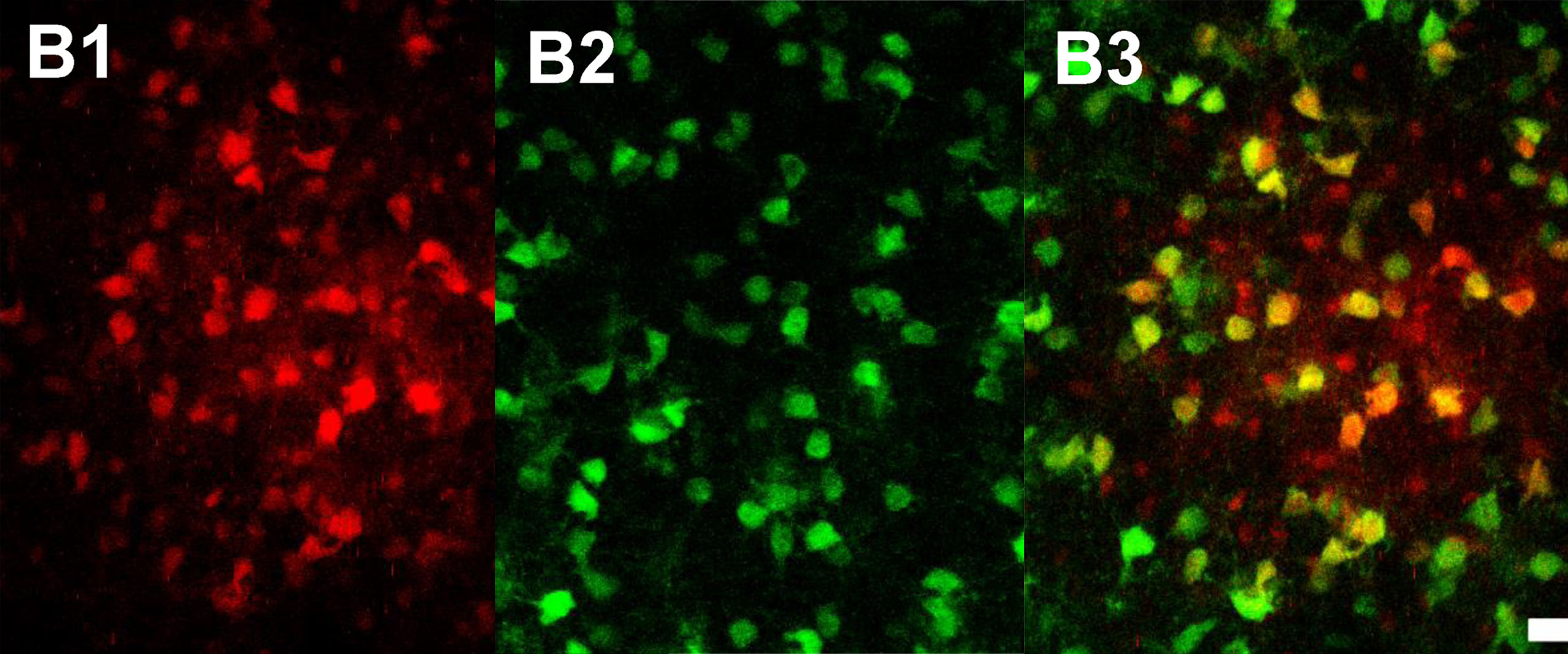 Wird ein Astrozyt im Thalamus mit Farbstoff gefüllt, diffundiert dieser in benachbarte Zellen des Netzwerks (rot). Darunter sind viele Oligodendrozyten (grün), wie die Überlagerung (B3, gelb) zeigt.