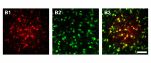 Wird ein Astrozyt im Thalamus mit Farbstoff gefüllt, diffundiert dieser in benachbarte Zellen des Netzwerks (rot). Darunter sind viele Oligodendrozyten (grün), wie die Überlagerung (B3, gelb) zeigt.
