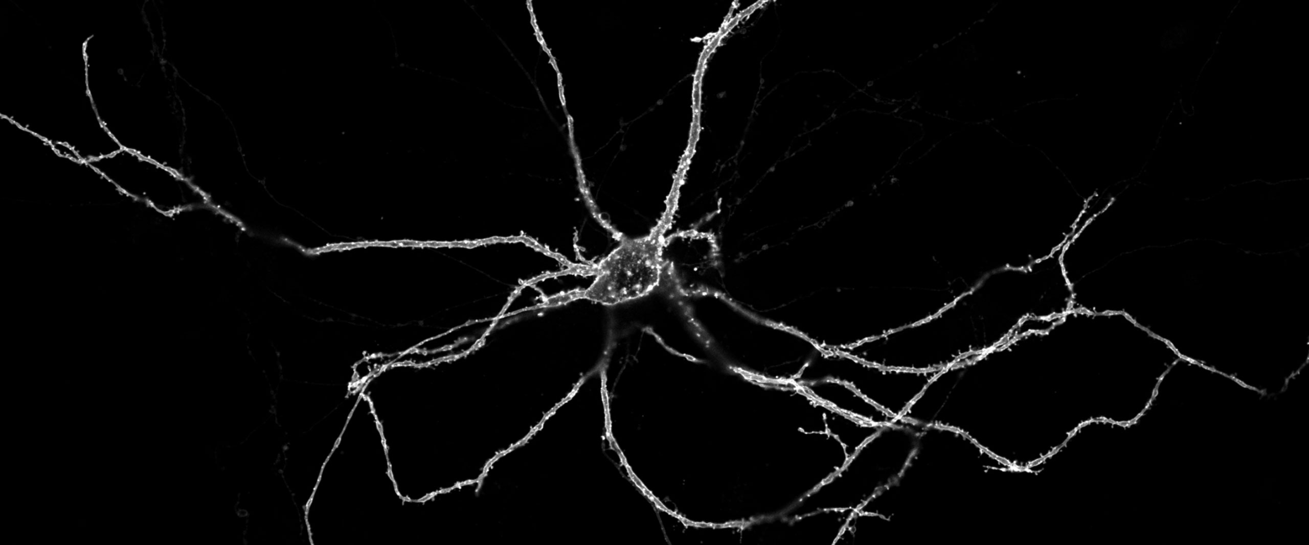 Bild einer lebendigen im Labor gezüchteten Nervenzelle