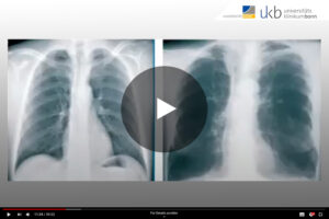 Videothumbnail PatKo COPD
