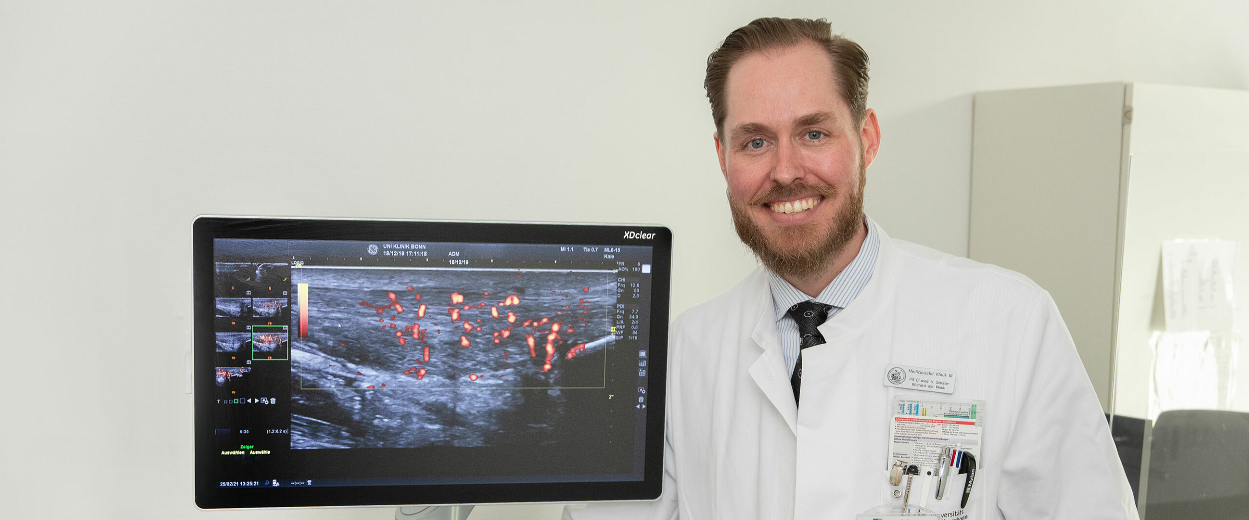 Mit verbesserter Bildgebung zu zielgerichteter Behandlung: Privatdozent Dr. Valentin Schäfer mit einem Ultraschall einer entzündeten und verdickten Achillessehne im Längsschnitt.