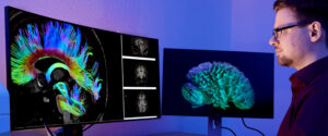Prof. Dr. Thomas Schultz und sein Team entwickeln Methoden für die Visualisierung und Auswertung von Neuroimaging-Daten.