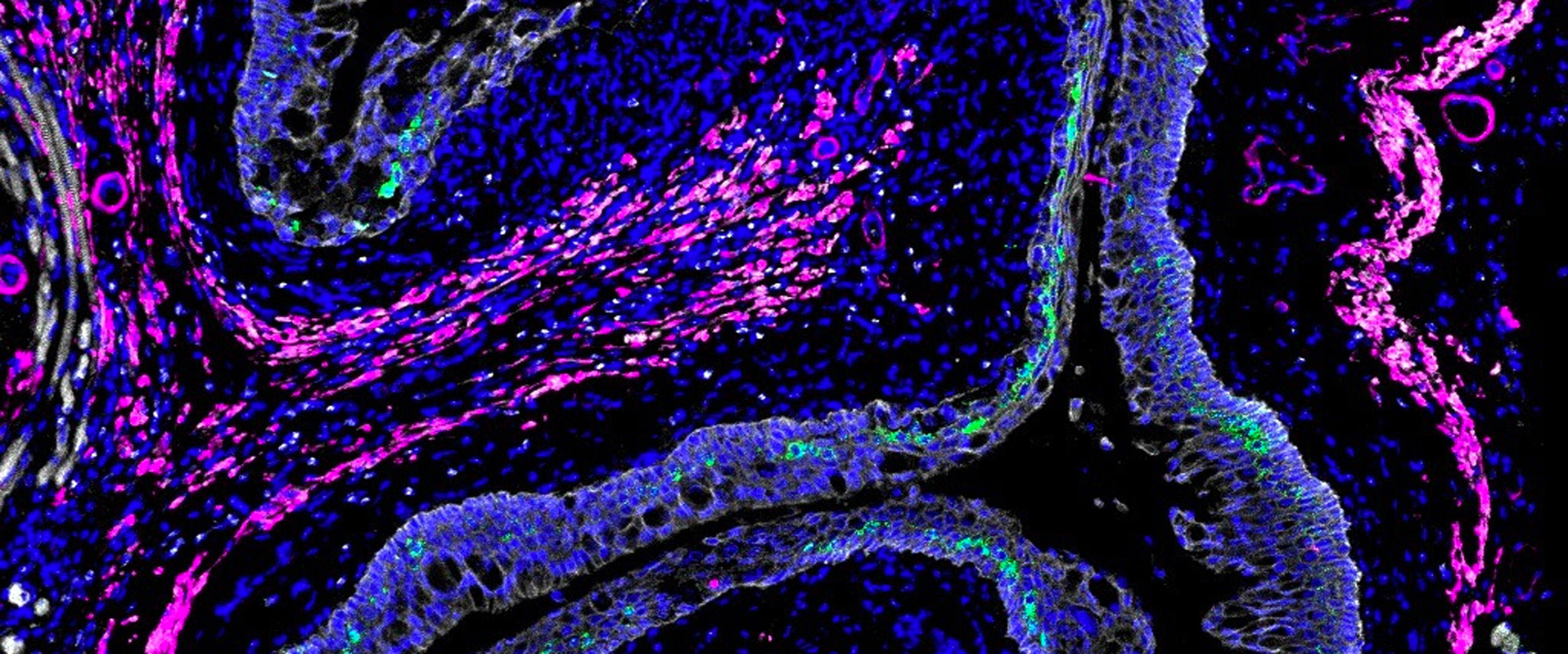 aus dem Genitaltrakt einer weiblichen Maus. Die genetische Bauanleitung von Interleukin-33 wurde grün angefärbt. Der Botenstoff sorgt indirekt für die Heranreifung der Granulozyten.