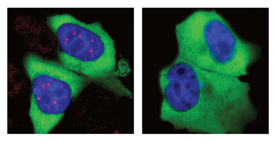 Im Zellkern menschlicher Zellen (blau)  konzentriert sich SMN in den Cajal-Körpern (links, rot)