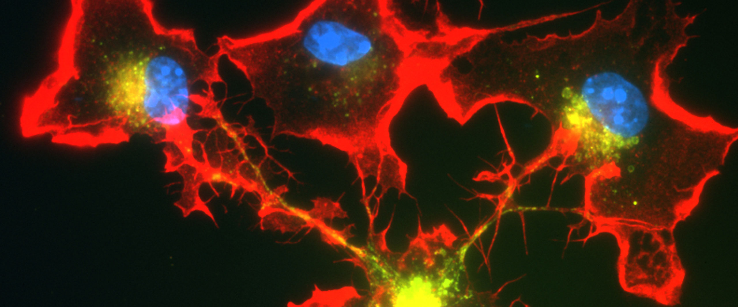 Immunzellen im Gehirn teilen sich die Arbeit auf