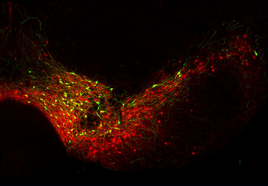 Dopaminerge Neurone im Mittelhirn einer Maus