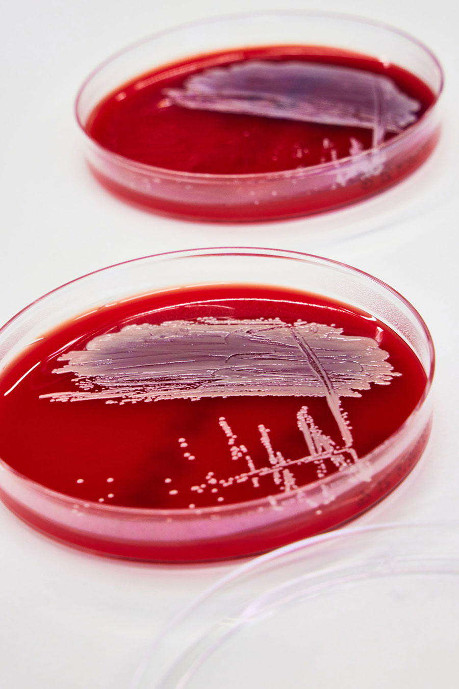 Staphylococcus aureus