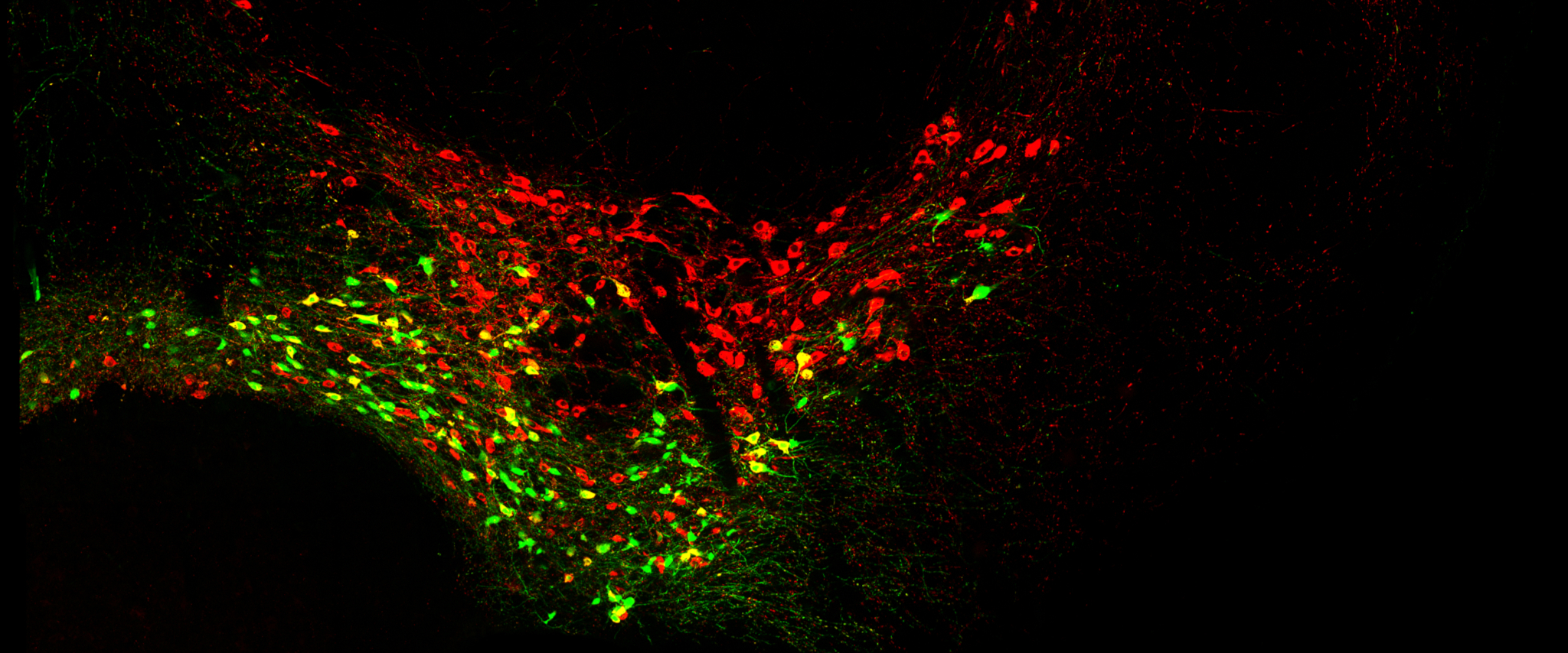 Früh geborenen Nervenzellen stehen viele Wege offen