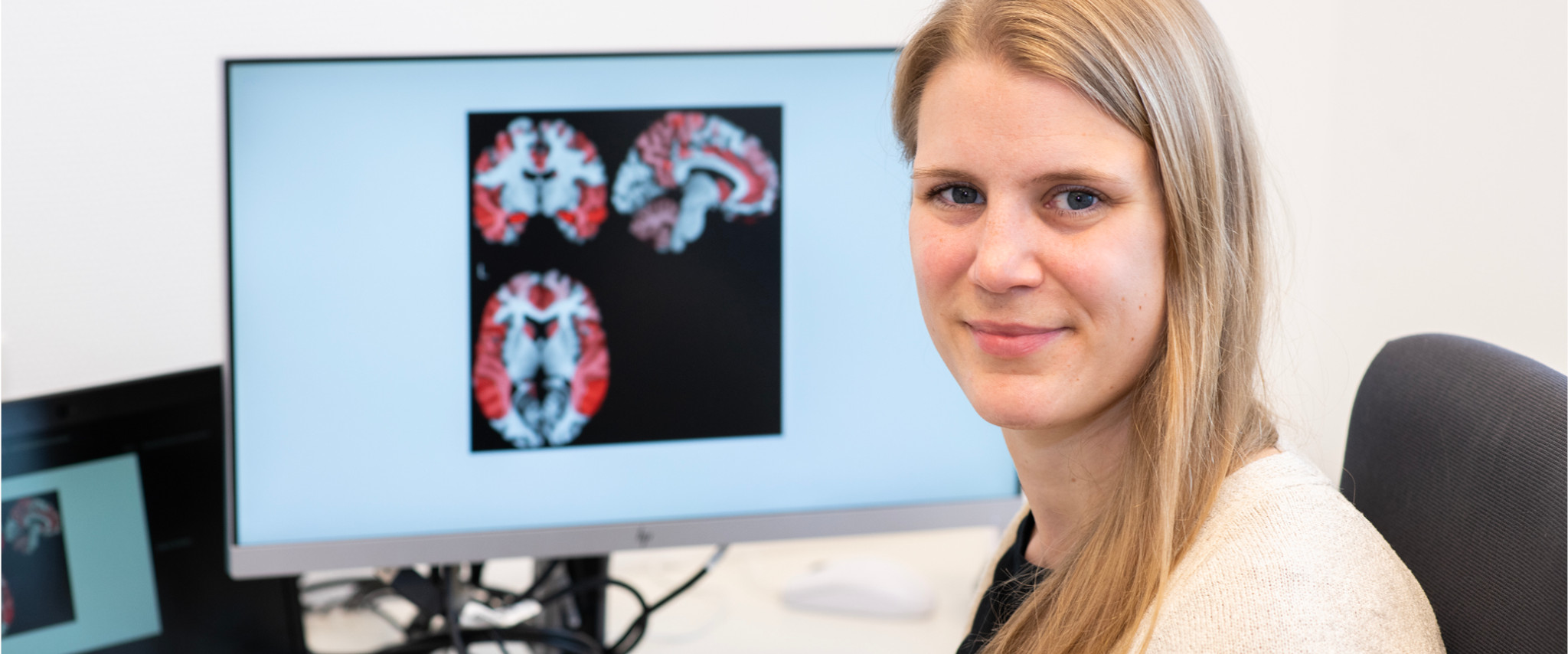 Marie Curie Stipendium geht an Psychologin des Universitätsklinikums Bonn