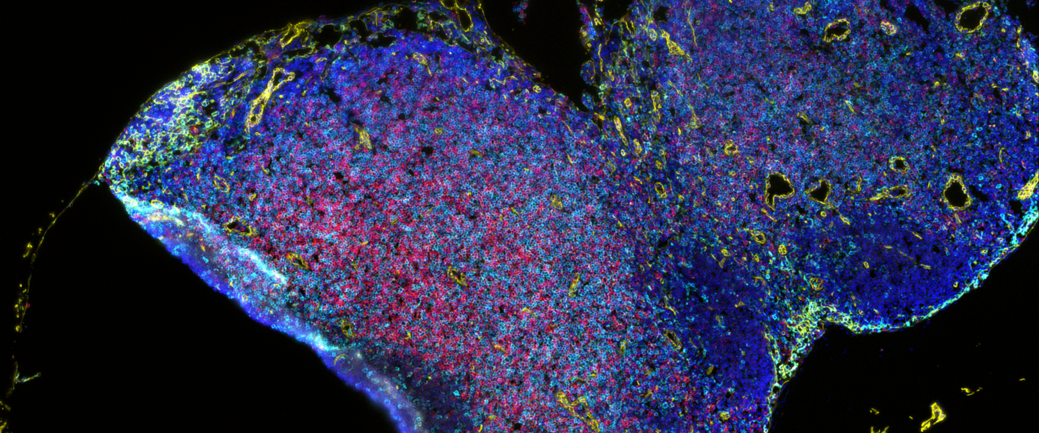 Künstliche Intelligenz soll Tumorimmunologie helfen