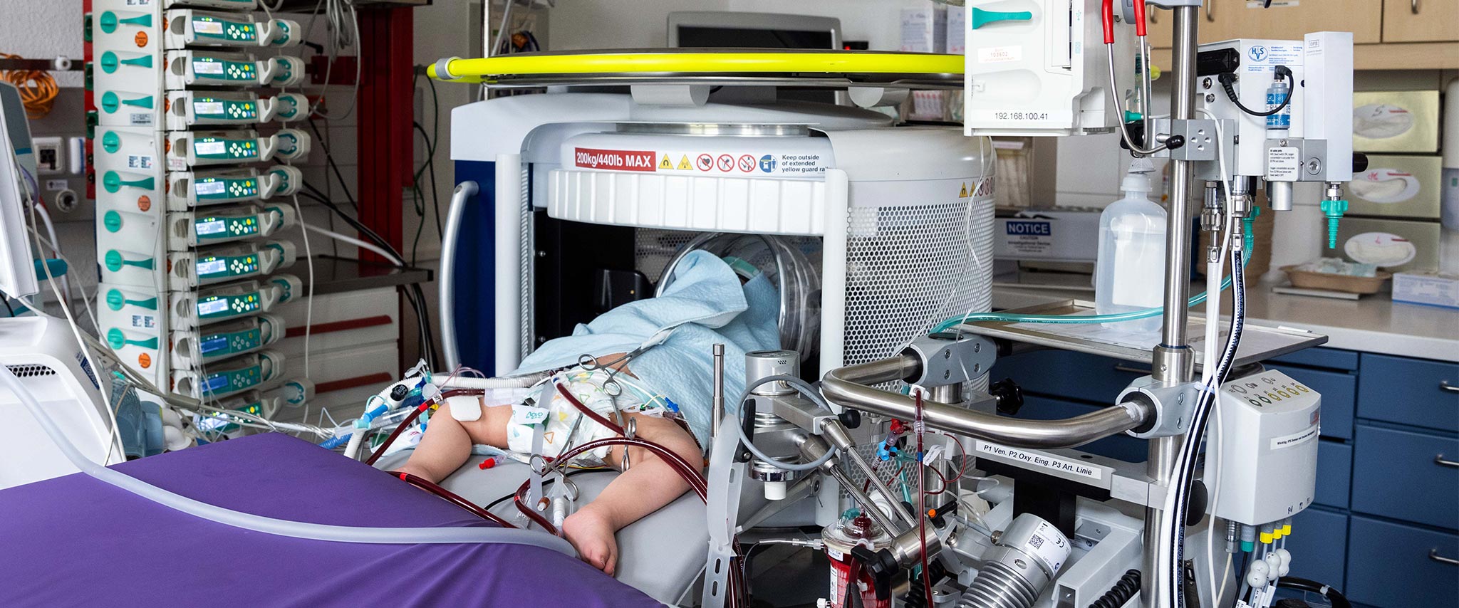 Weltweite erste Untersuchungen mit mobilem MRT bei pädiatrischen ECMO-Patientinnen und -Patienten