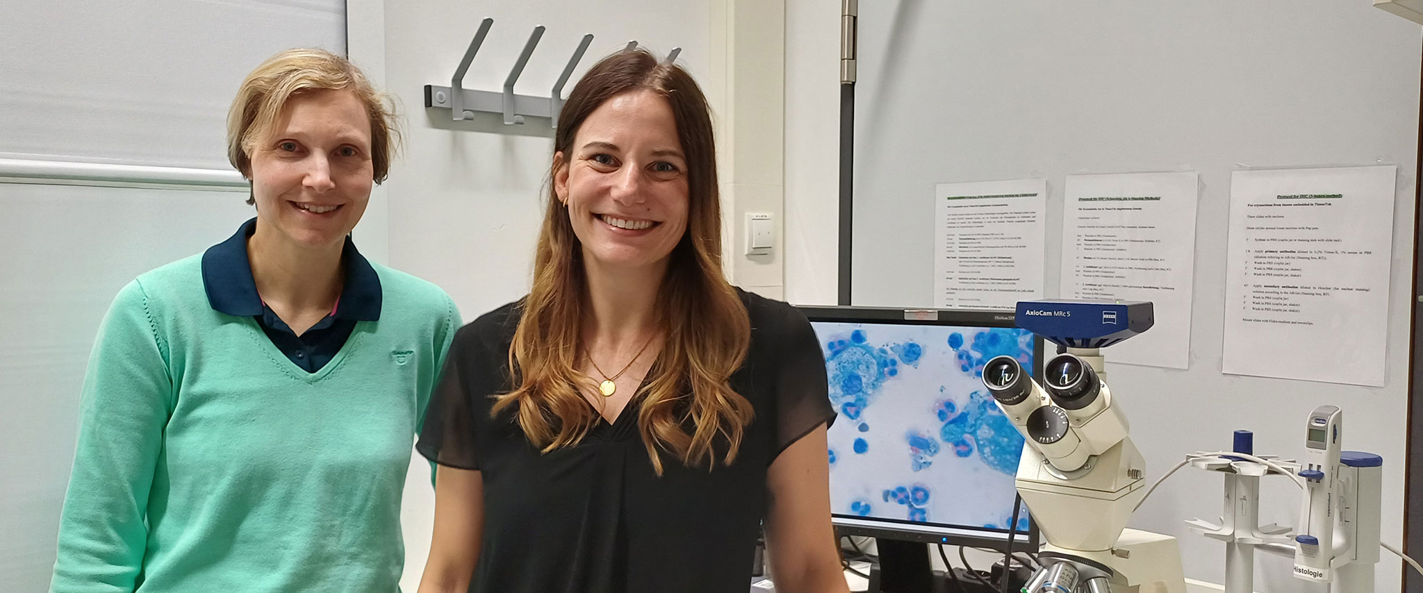 Ein neuer Ansatz gegen Bronchienverengung durch Asthma