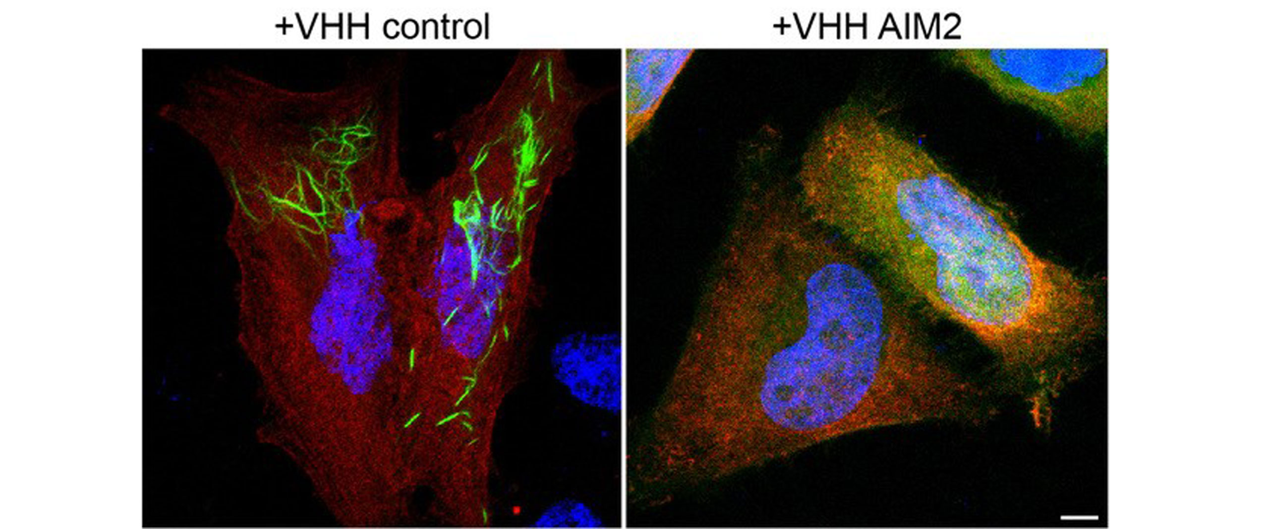 Neue Einblicke in die menschliche Immunabwehr gegen Pockenviren