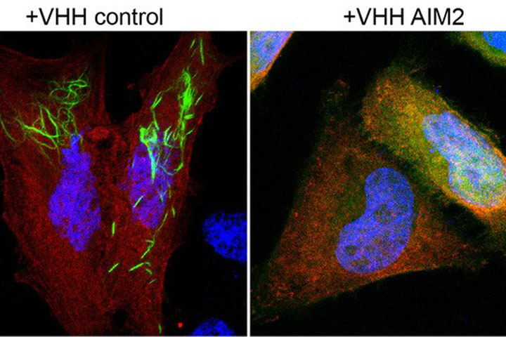 AIM2-PYD-Filamente (grün) bilden sich in Anwesenheit eines Kontroll-Nanobodies (rot). Rechts: Die Bildung von AIM2-PYD-Filamenten wird durch AIM2-spezifische Nanobodies (rot) gehemmt. Zellkerne sind blau dargestellt.