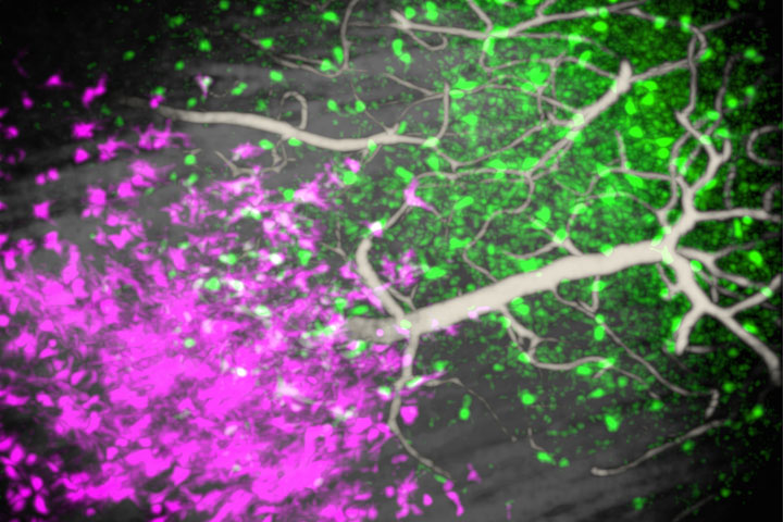 Zusammenspiel mehrerer Glioblastomzellen (magenta) und Immunzellen (grün) im Gehirn einer lebenden Maus, aufgenommen mit moderner Drei-Photonen-Mikroskopie.