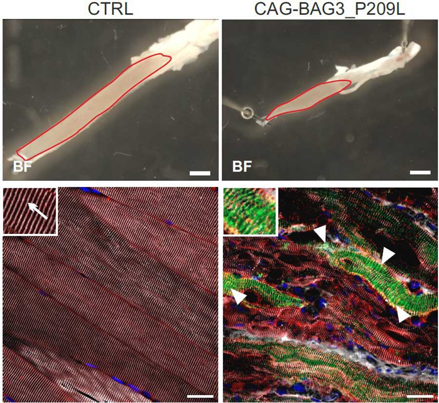 Skelettmuskeln einer gesunden (oben links) und einer kranken Maus (oben rechts). Die Muskeln der kranken Maus sind deutlich kleiner und weisen geschädigte Sarkomere (unten rechts, rot), sowie BAG3_P209L-Ablagerungen (unten rechts, grün) auf, die zu einer verminderten Kraftentwicklung führen.